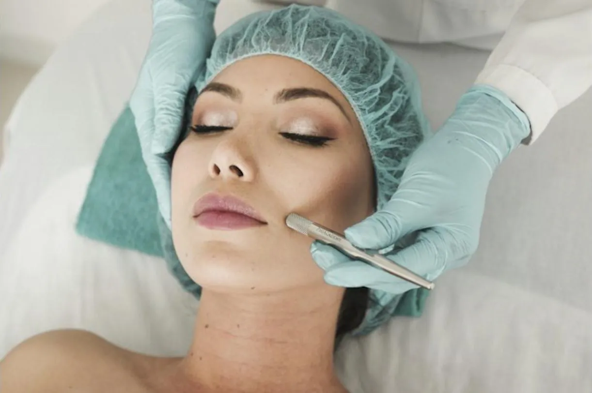 Dermaplaning treatment at RJ Aesthetics