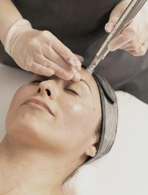 Facial treatment device in use at RJ Aesthetics